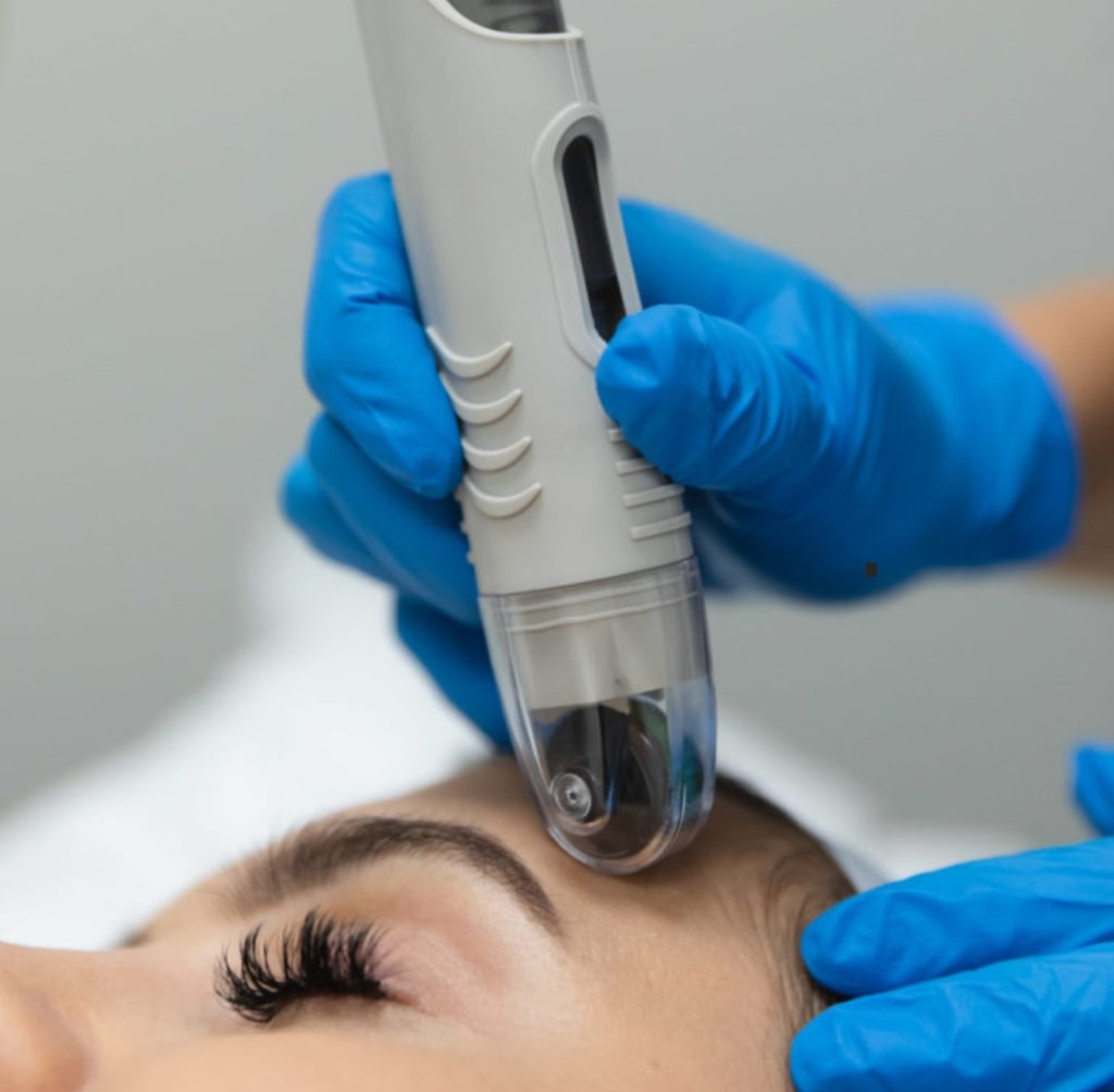 Skin treatment result 14