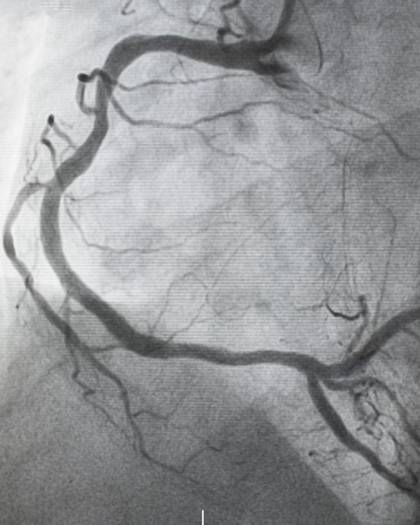 Arterien-Duplex Coburg – ABI-Messung bei med.aesthetic