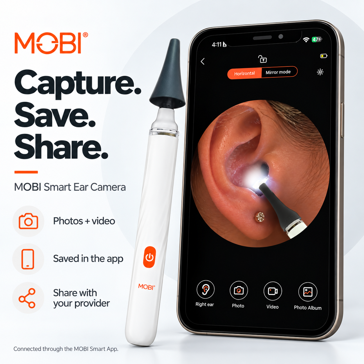 Smart Otoscope Jr. — Ear, Nose, Throat 1080P HD Camera feature 7