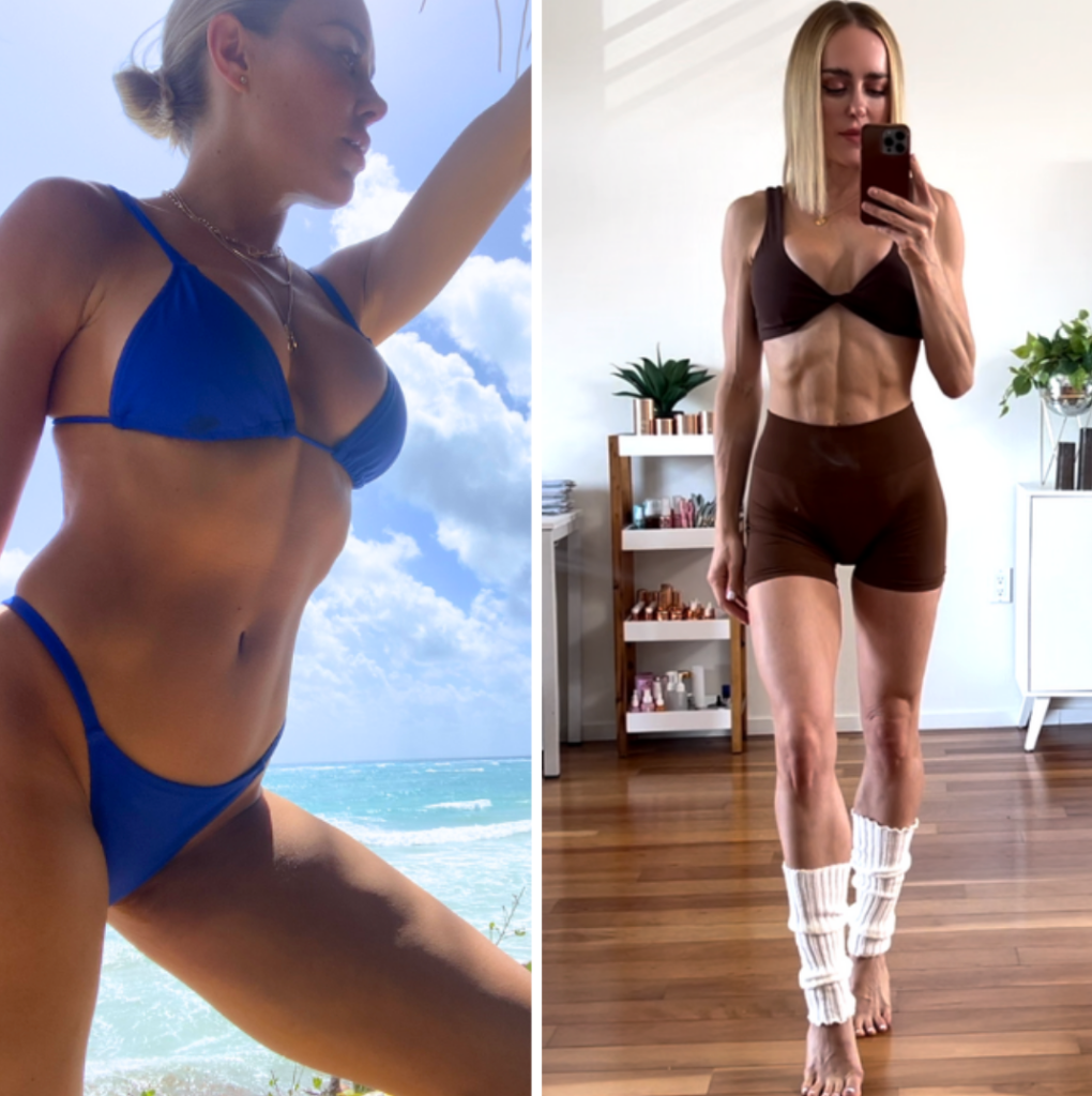 Alexis — Before & After
