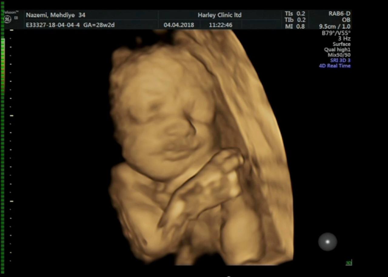 Darian — 4D scan, Harley Clinic, April 2018