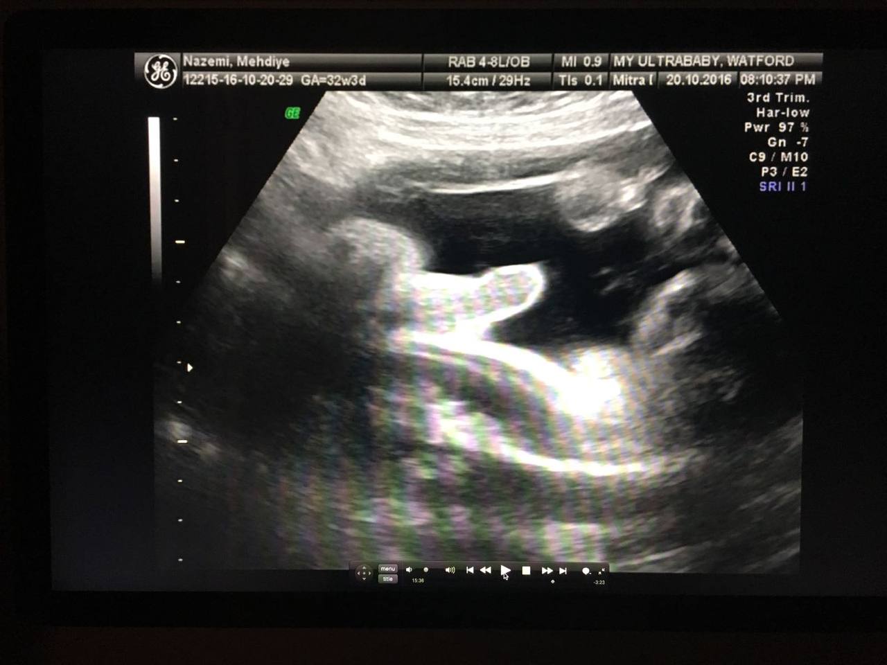 Adrian — scan, MY ULTRABABY Watford, October 2016