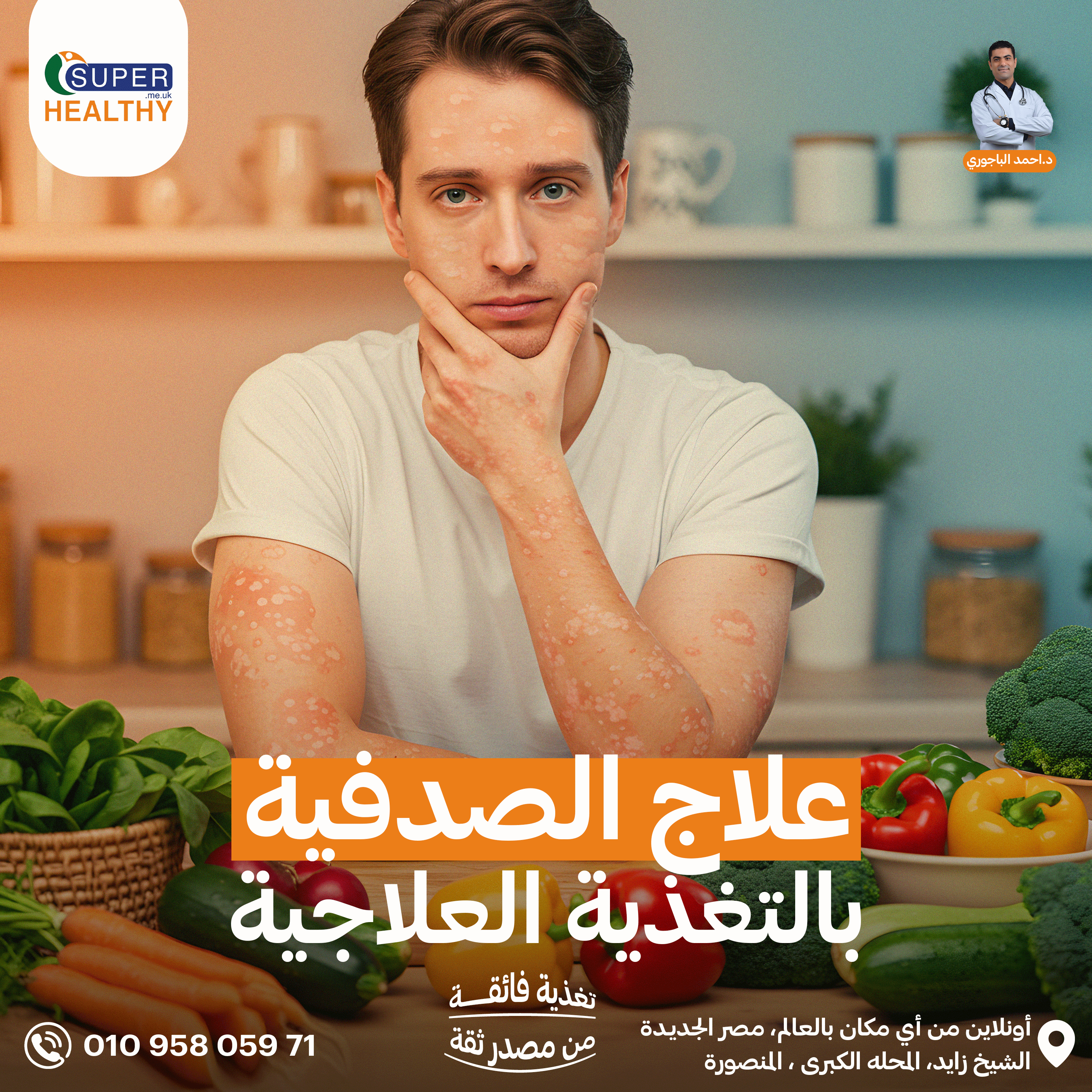 علاج الصدفية بالتغذية العلاجية