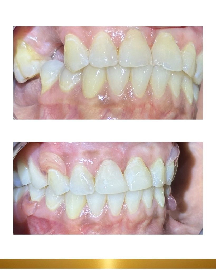 Before and after 10