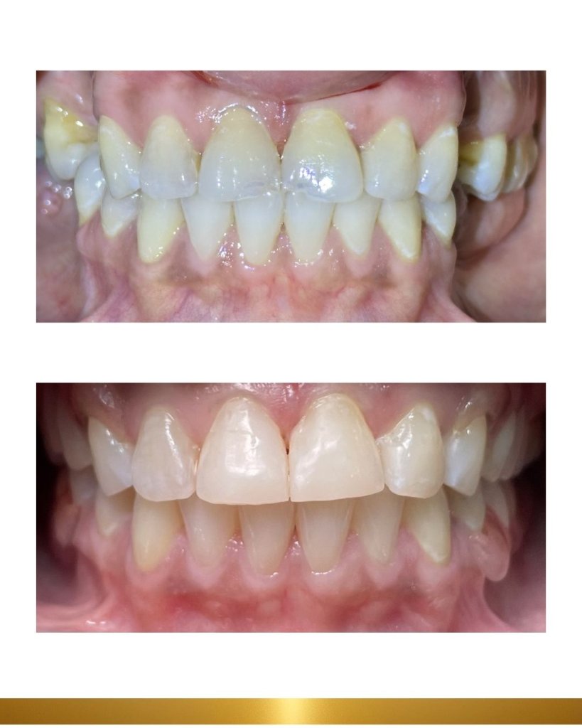 Before and after 8