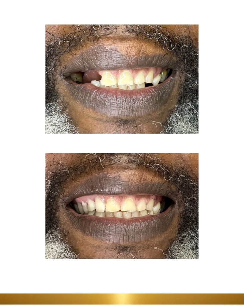 Before and after 16