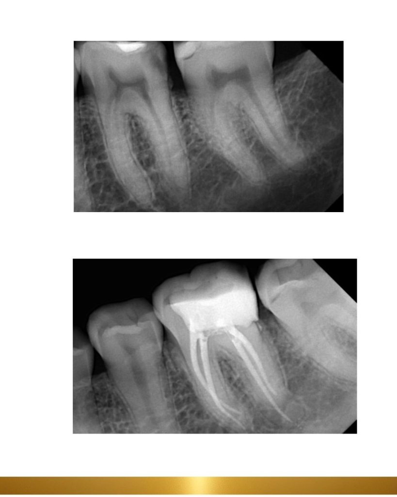 Before and after 13