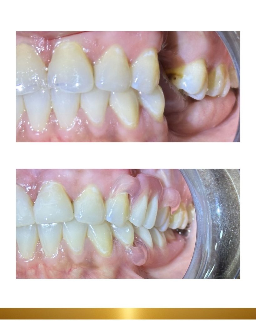Before and after 9