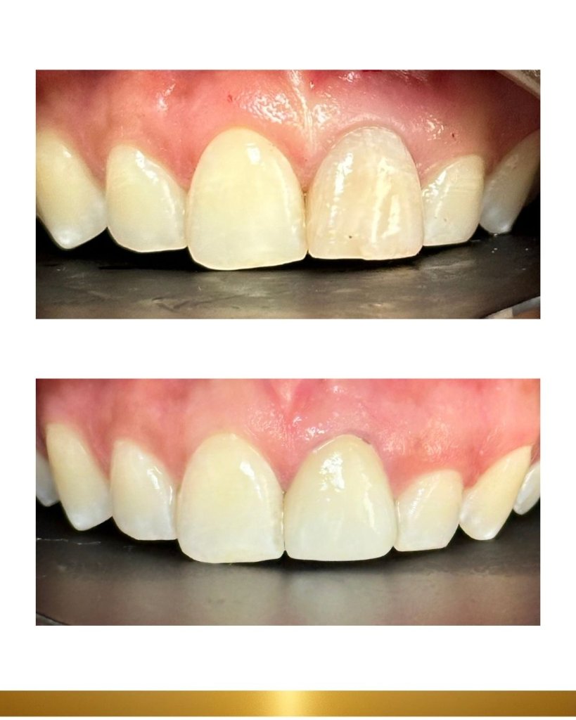 Before and after 12