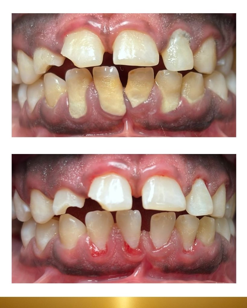 Before and after 6