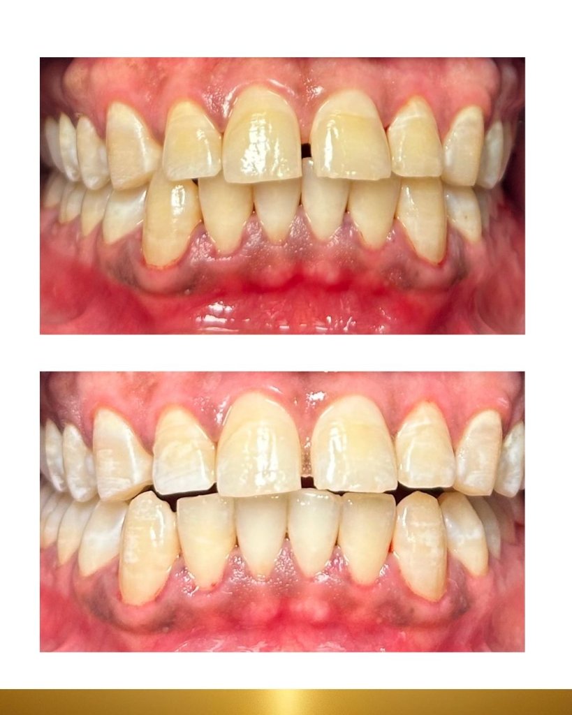 Before and after 3