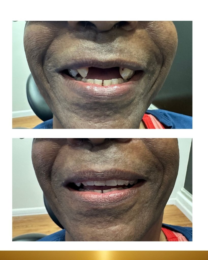 Before and after 7
