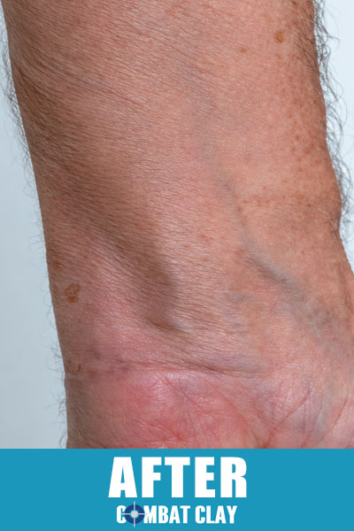 Clear skin on wrist after using Combat Clay Soothing Skin Spray