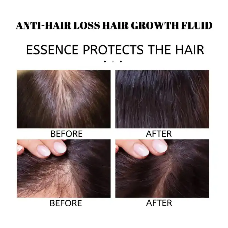 Before and after hair growth results