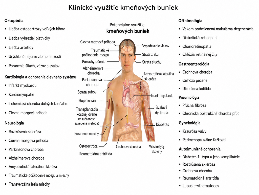 Klinické využitie kmeňových buniek