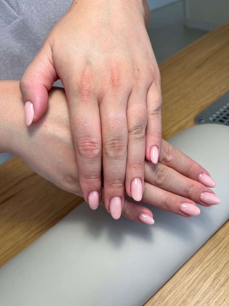 Nagelbehandelingen