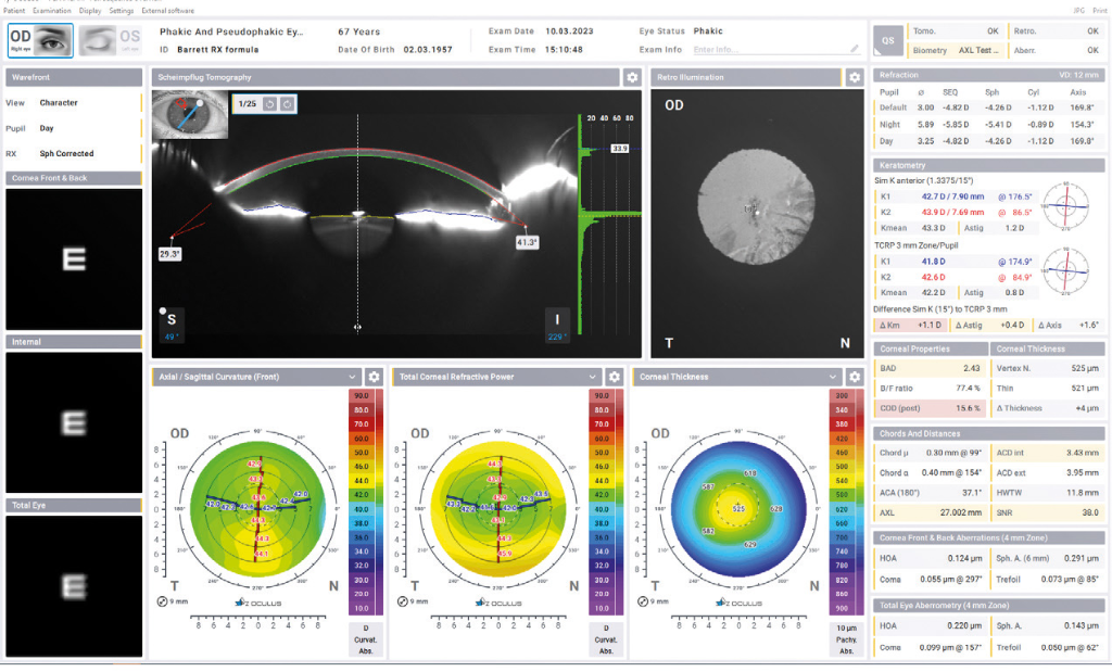 Phakic Eye Cataract Analysis