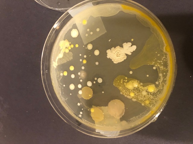 Outreach: Examining bacterial growth on agar