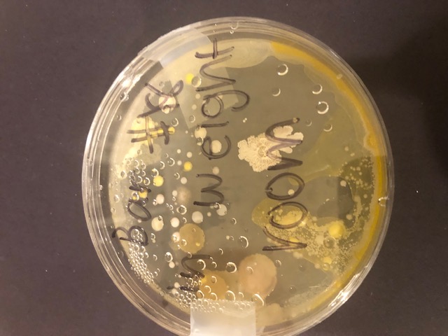 Outreach: Petri dish microbial colonies