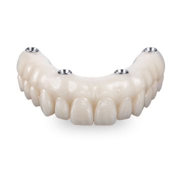 AOX PMMA Temporary Bridge
