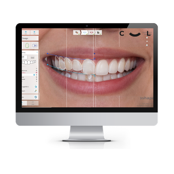 Digital Smile Planning