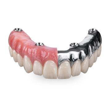 Individual Crown Hybrid Bridge