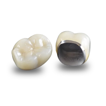 Porcelain-Fused-to-Metal
