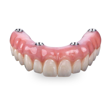 Full-Arch Monolithic Zirconia Bridge