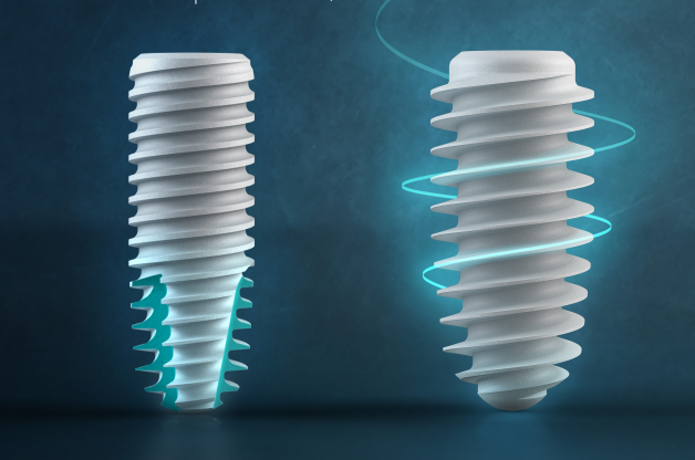 Implants dentaires en titane Biotech Dental Kontact, fabriqués en France, posés au Médipôle de Schiltigheim