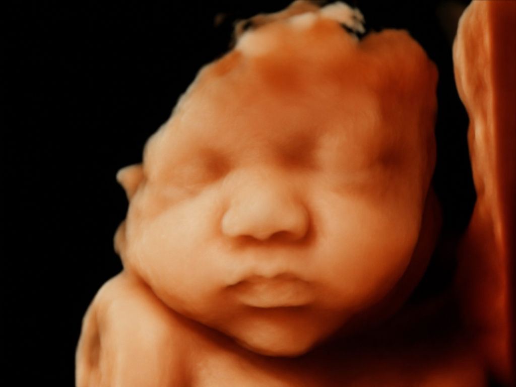 Watch Me Grow 1