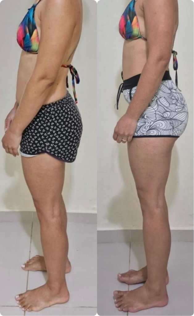 Resultado 4 — Antes e Depois