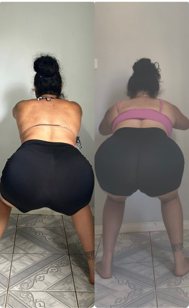 Resultado 6 — Antes e Depois