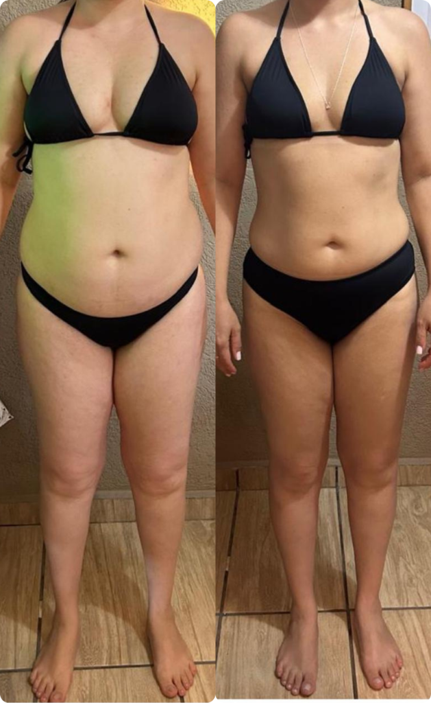 Resultado 10 — Antes e Depois