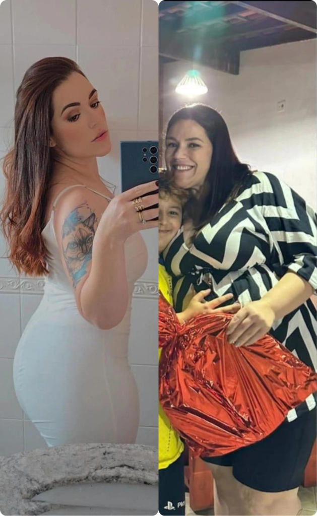 Resultado 9 — Antes e Depois