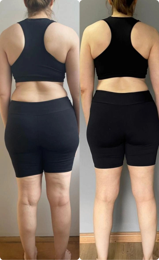Resultado 1 — Antes e Depois
