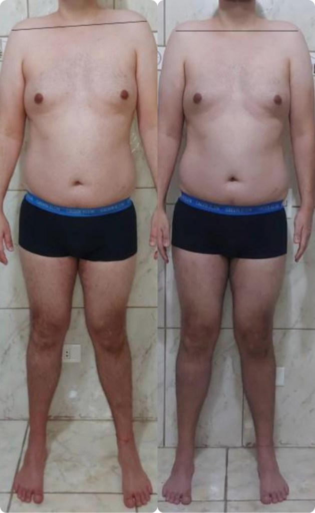 Resultado 5 — Antes e Depois
