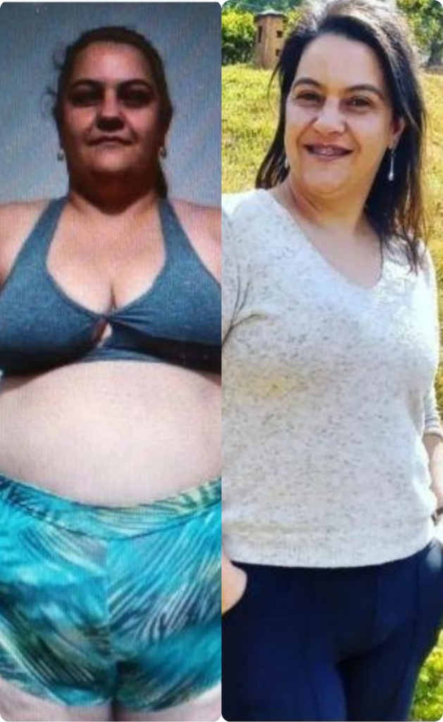 Resultado 11 — Antes e Depois