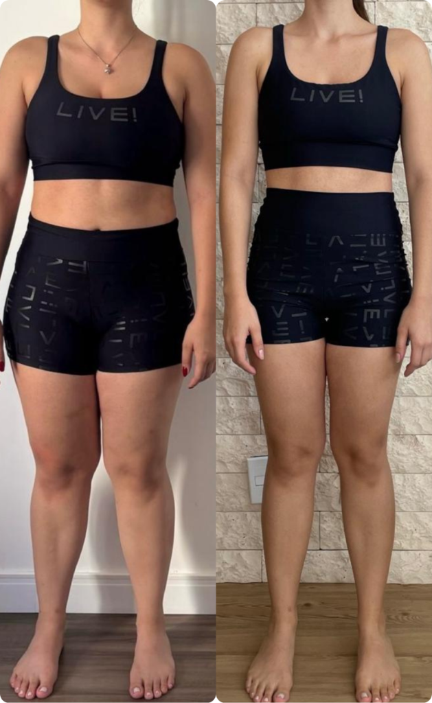 Resultado 3 — Antes e Depois