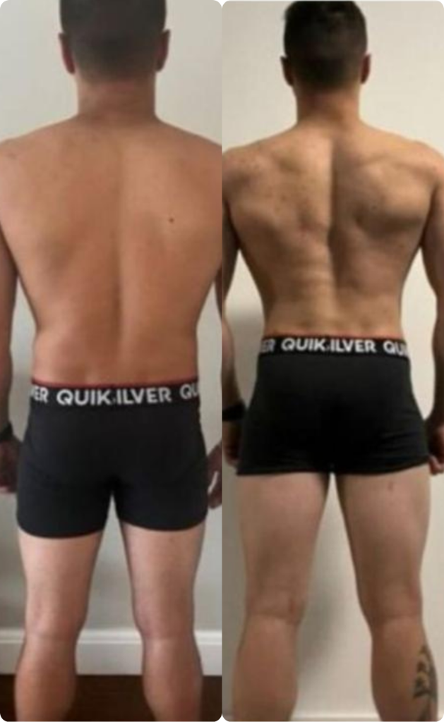 Resultado 2 — Antes e Depois