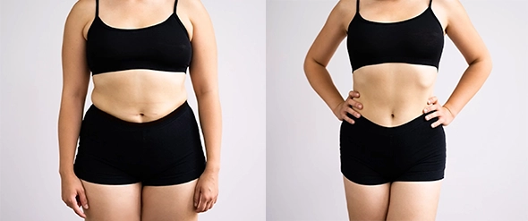 Abdomen before and after