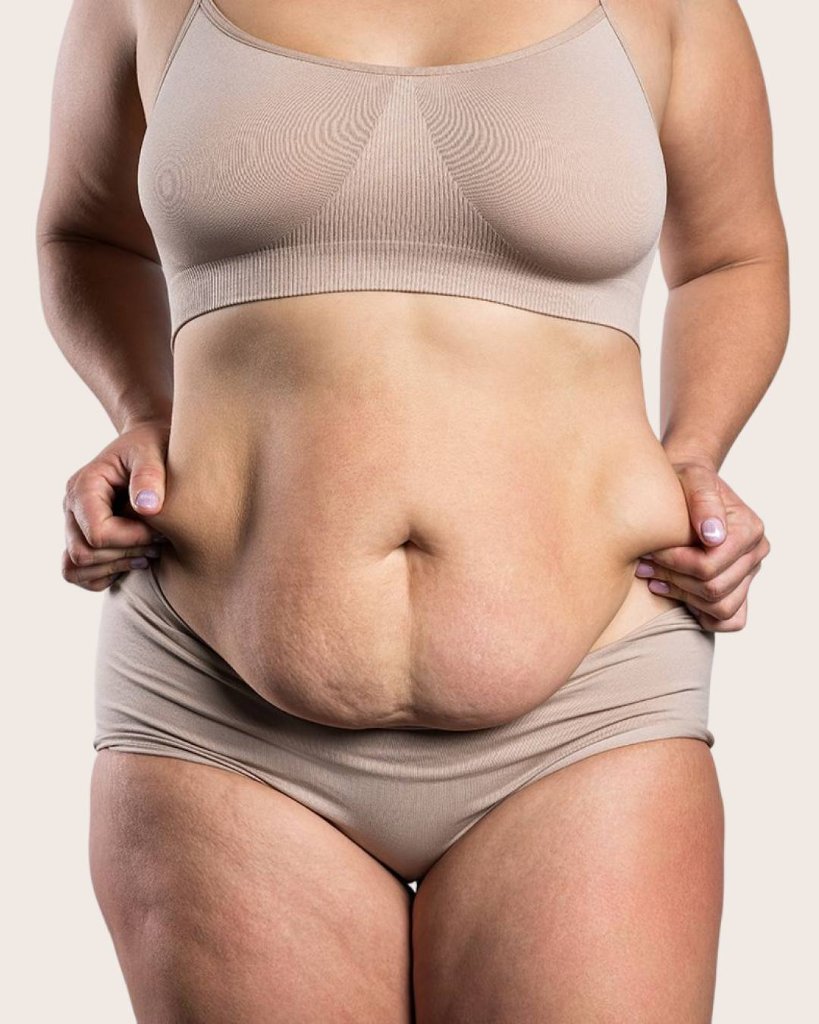 Before and after fat reduction treatment
