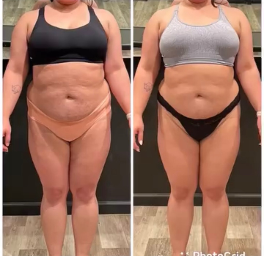 Weight Loss Transformation