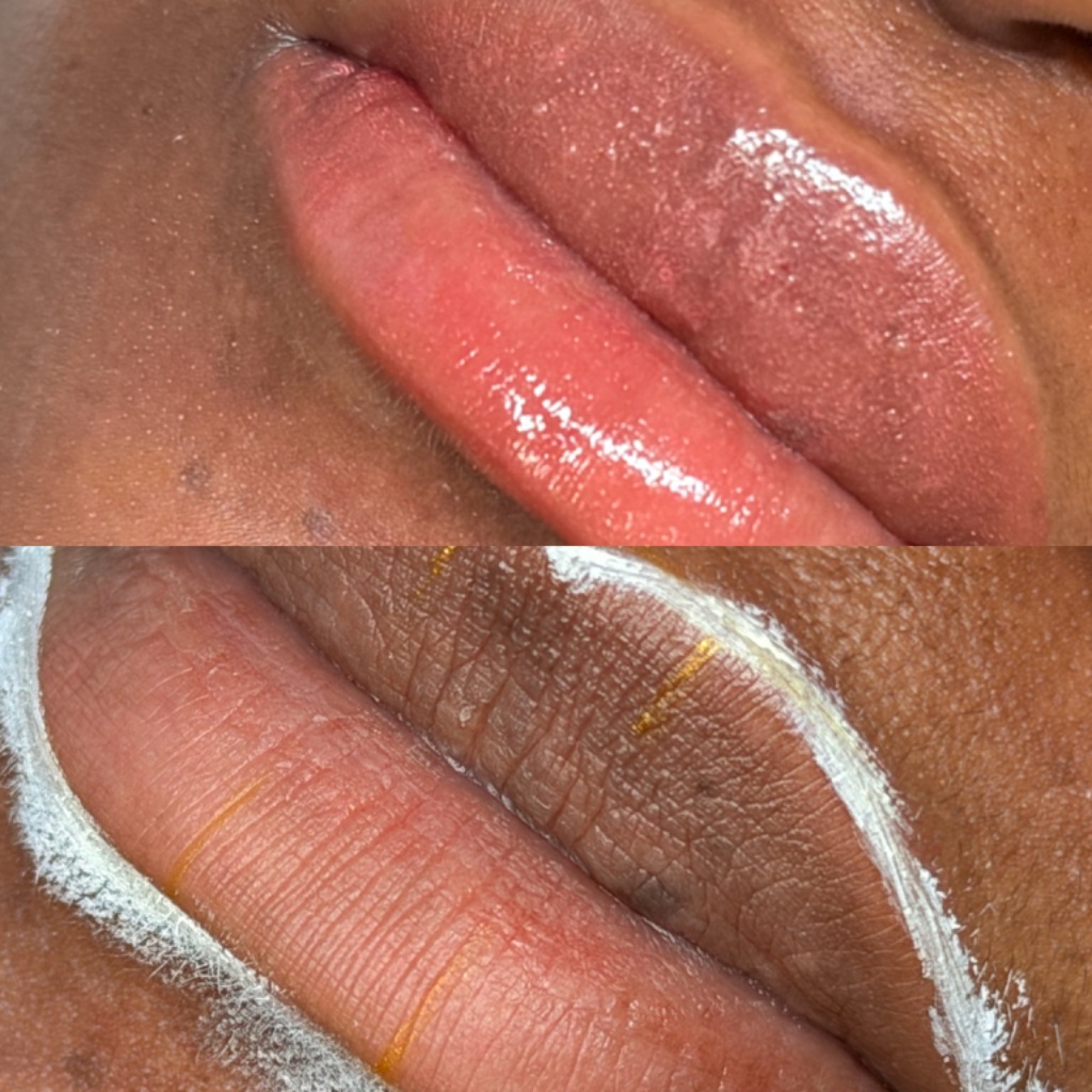 PMU Lip Blush — Hyperpigmentation Correction