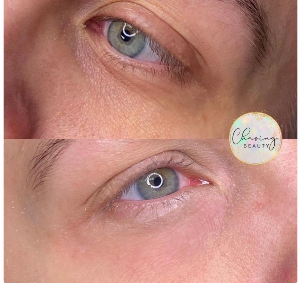 Under Eye Camouflage Result 3