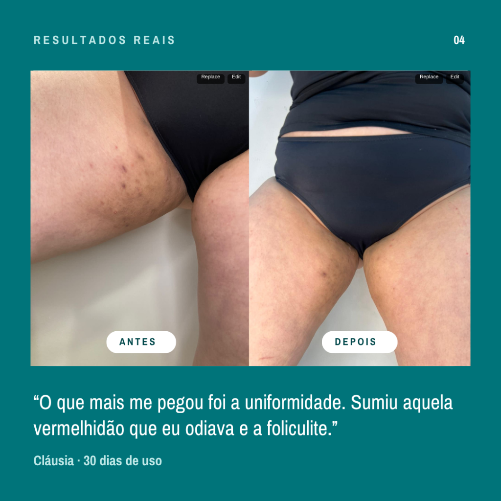 Resultado real — depoimento 4