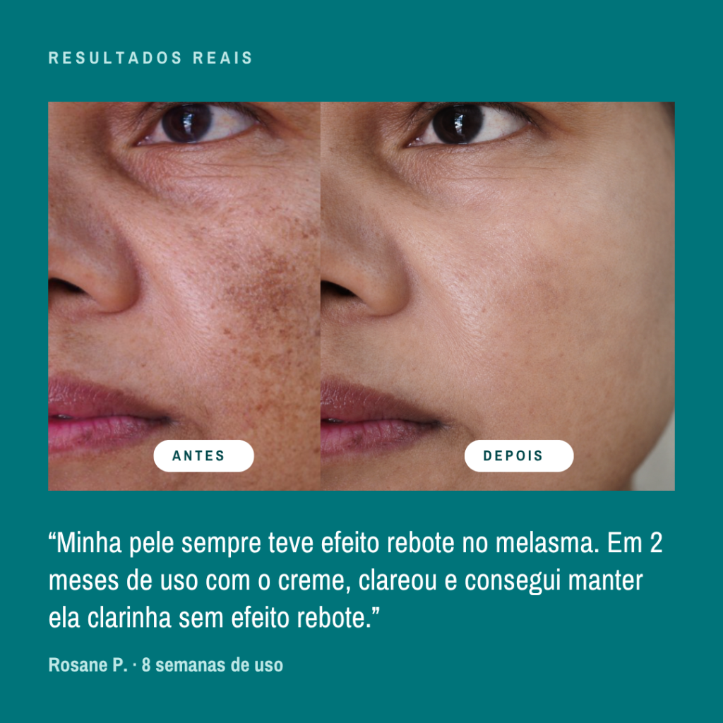 Resultado real — depoimento 2