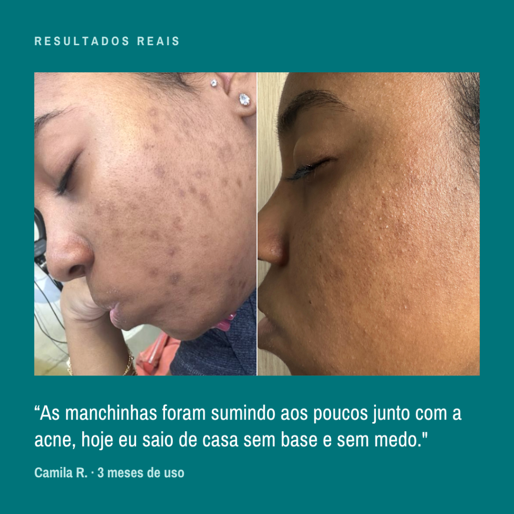 Resultado real — depoimento 1