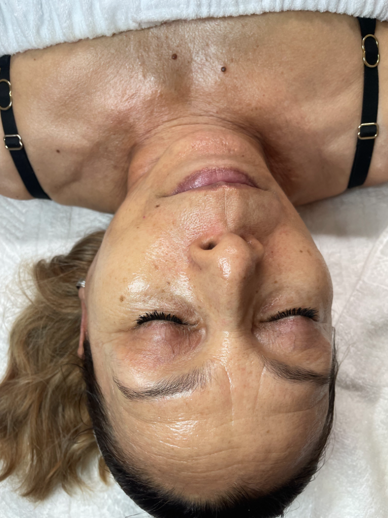 Age-Defying Rejuvenation Facial after