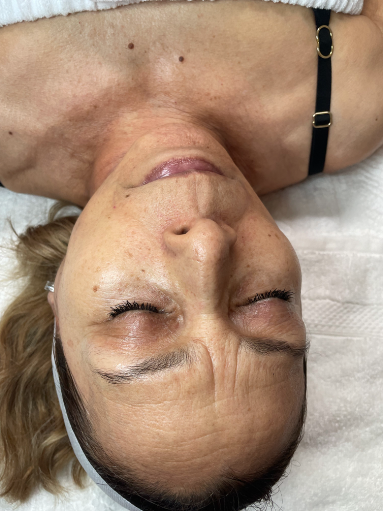 Age-Defying Rejuvenation Facial before