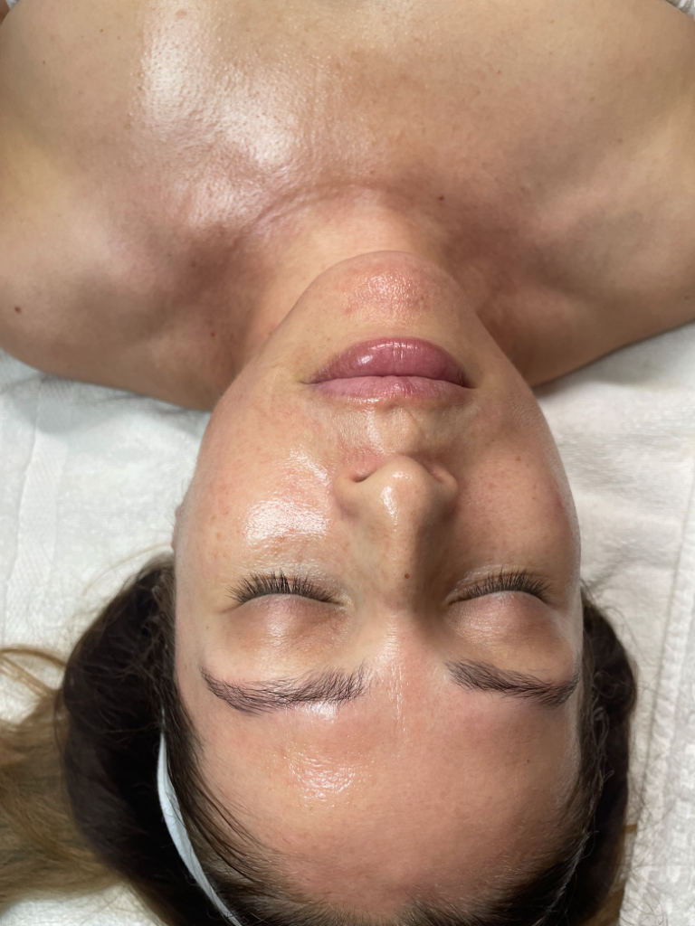 Luxury Dermaplaning Facial after